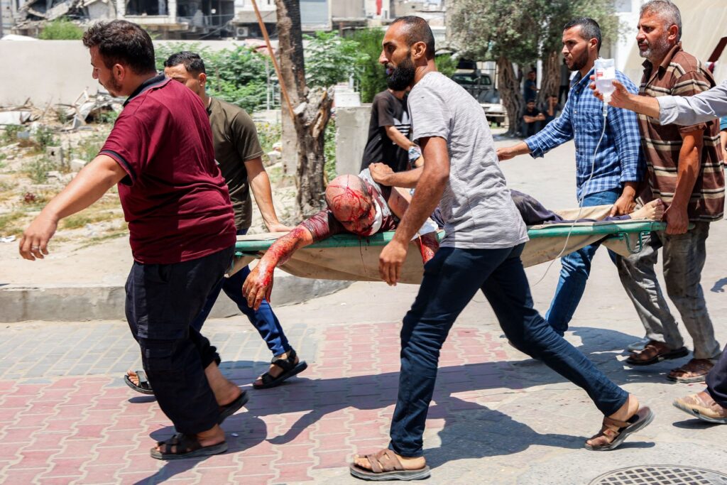 Hospital de Gaza anuncia que 21 menores fallecieron de malnutrición y hambre en las últimas 72 horas