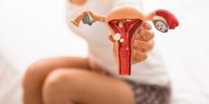 Minsa alerta: cólicos menstruales intensos podrían indicar endometriosis
