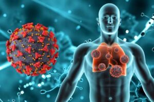 Casos de neumonía suben en Piura y golpean con mayor fuerza a adultos mayores