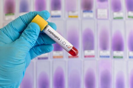 Fallas en agua, drenaje y recolección de basura incrementan el riesgo de leptospirosis en Piura