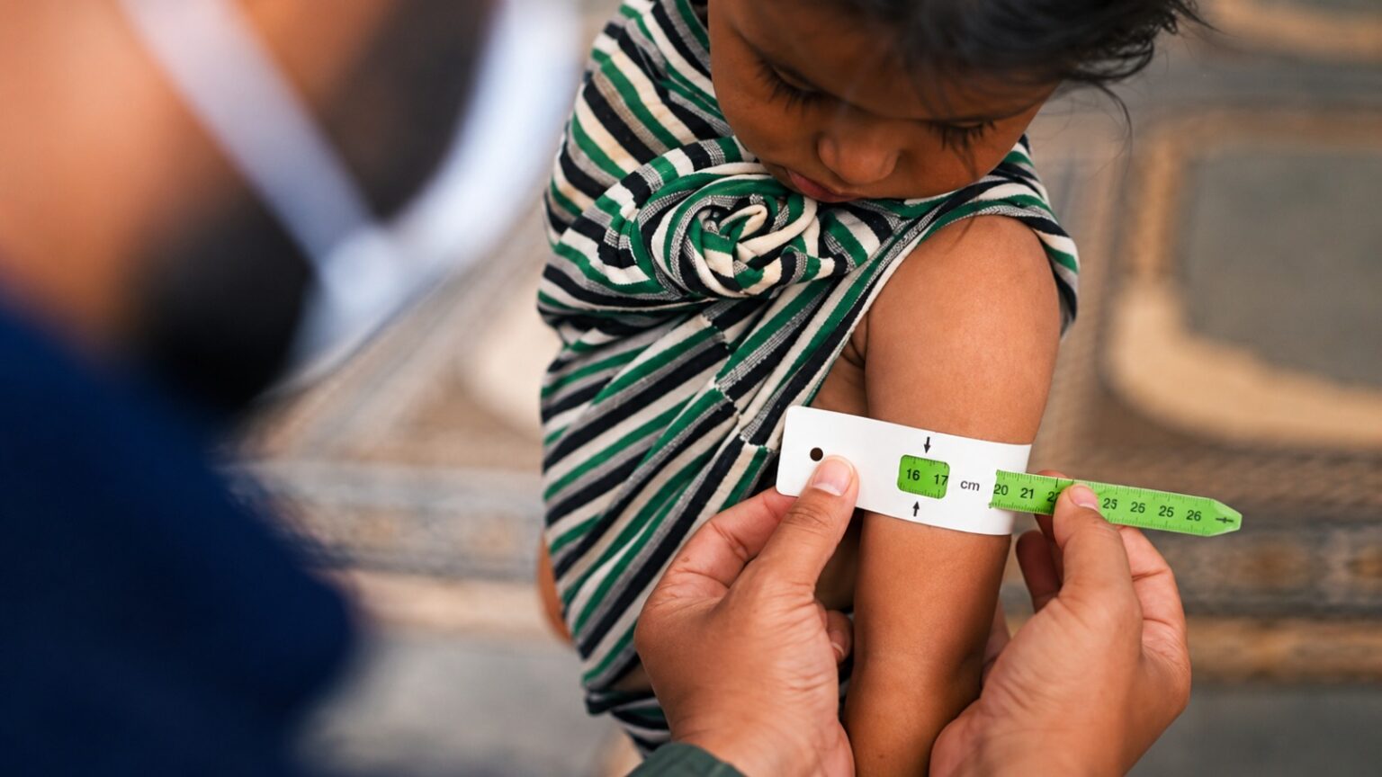 Desnutrición crónica infantil afecta al 15% de los niños menores de cinco años en Piura